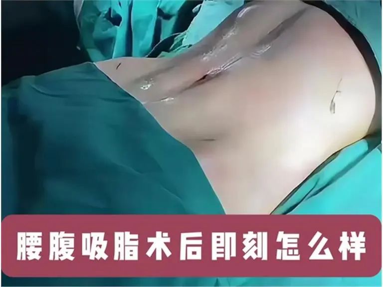运动减脂计划_运动减肥计划_运动减脂计划怎么写